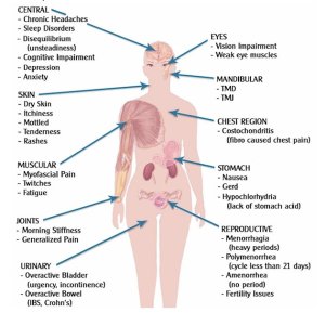 erl 2020-12-26 #3 Pix 10 Fibro-Pain-Areas all Fiona (panda68-UK).jpg